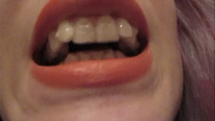 Invisalign and red lips