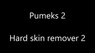 Hard skin remover part 2