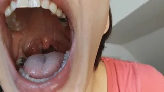 check my mouth