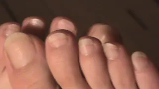natural toenails