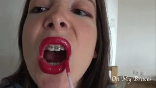 Red lipstick on girl with braces