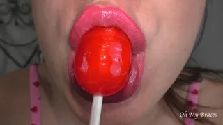 Mmmh... I suck lollipop like in a blowjob (braces edition)
