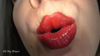 Extreme close-up of my red lips and braces, puckering lips and kisses noise