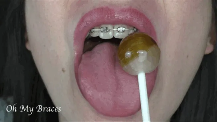 Close-up lollipop licking with braces