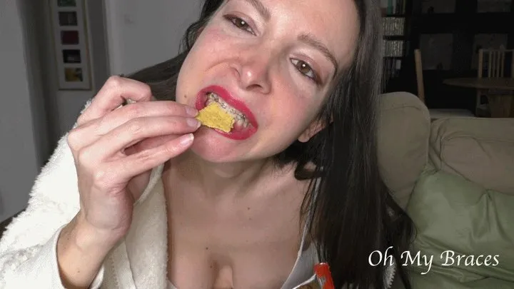 Chewing crunchy nachos (braces edition)