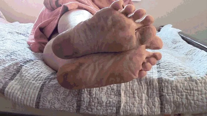 Sofia's dirty feet suffer from severe itching