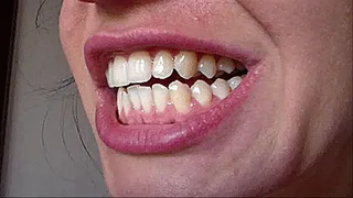 Milena's white teeth...