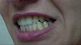 Diamond teeth...