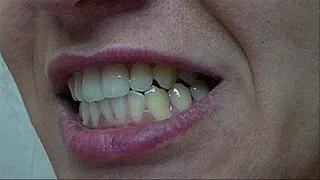 Diamond teeth