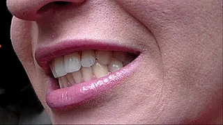 Sharp teeth of Milena