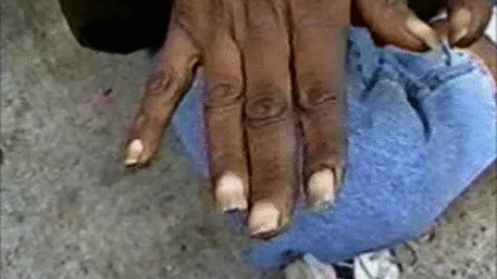 Filthy Fingernails of Homeless Woman in NYC