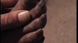 Two Monster Looking toenail videos in one from Long Nailed Black woman Diane