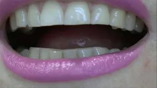 Showing sharp edges of incisors and canines