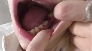 Embarressing Teeths and Mouth Tour