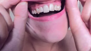 Dangerous Teeths