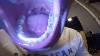 Tongue and Mouth Clip