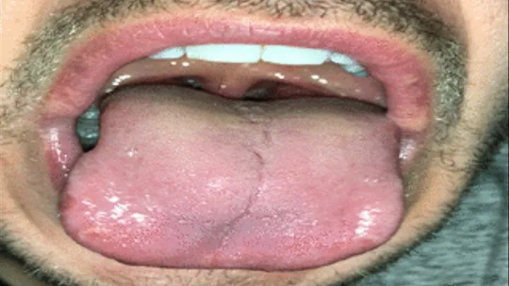 Lips Mouth Tongue and Tonsils