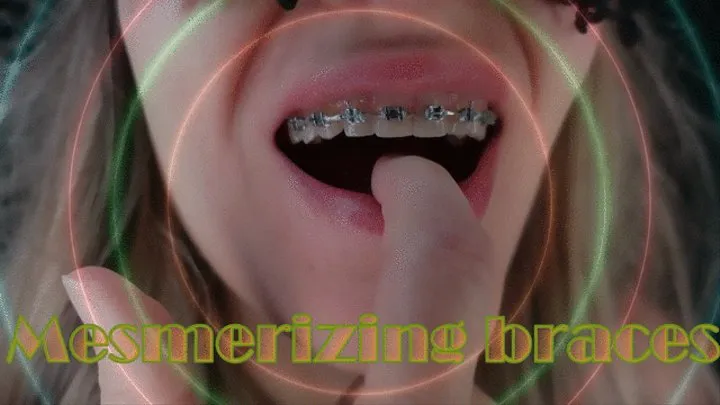 Mesmerizing braces