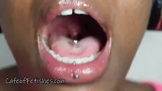 My Wide Mouth 7: Uvula Examination