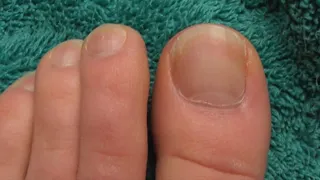 Sucking On My Pinky Toes