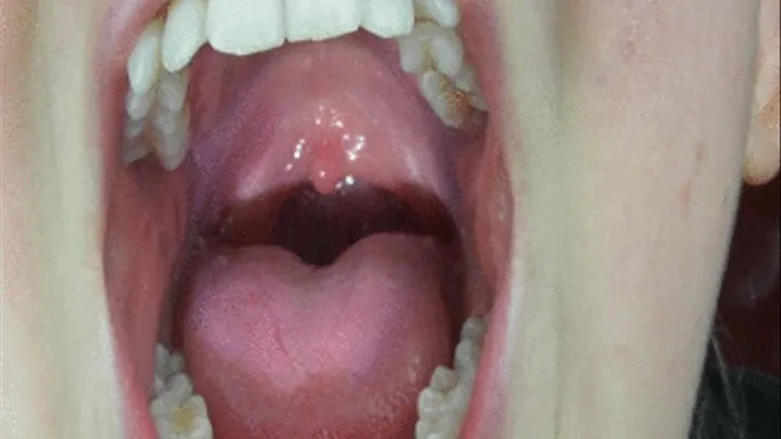 UP CLOSE AND PERSONAL: SAYING AHHHH AND HEAVY BREATHING WITH MY UVULA