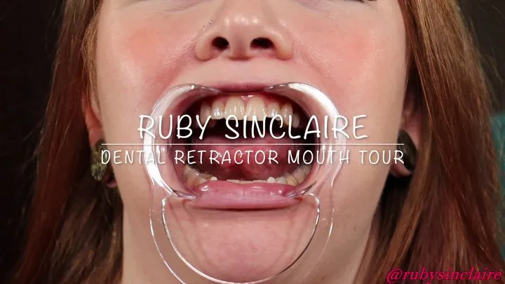 Ruby Sinclaire Dental Retractor Mouth Tour