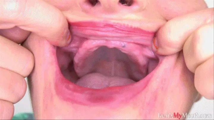 Inside My Mouth - Tereza teethless girl