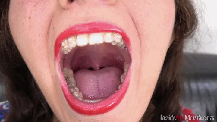 Inside My Mouth - Rani