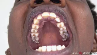 Inside My Mouth - Winnie