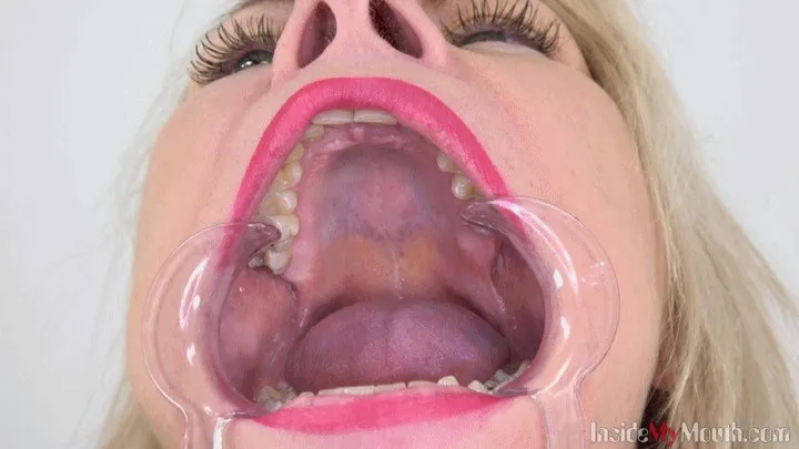 Inside My Mouth - Andrea 2