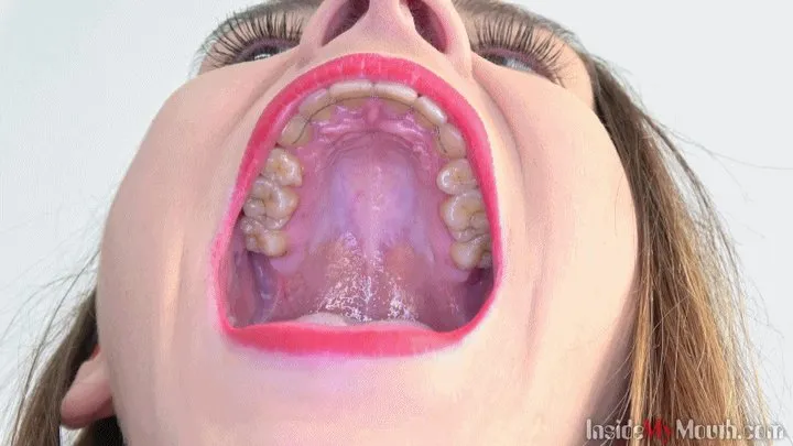 Inside My Mouth - Adele Unicorn got mouth exam