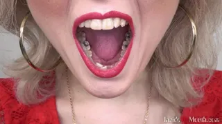 Inside My Mouth - Lenka got mouth exam