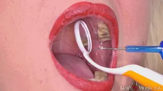Inside My Mouth - Sarah has a dental check-up