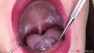 Inside My Mouth - Karolina got mouth exam