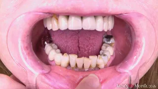 Inside My Mouth - Zuzana