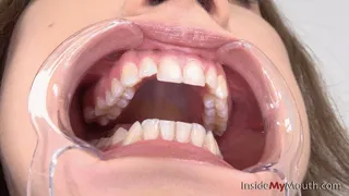 Inside My Mouth - Yulia - Mouth retractor clip! ( )