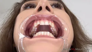 Inside My Mouth - Yulia - Mouth retractor clip!