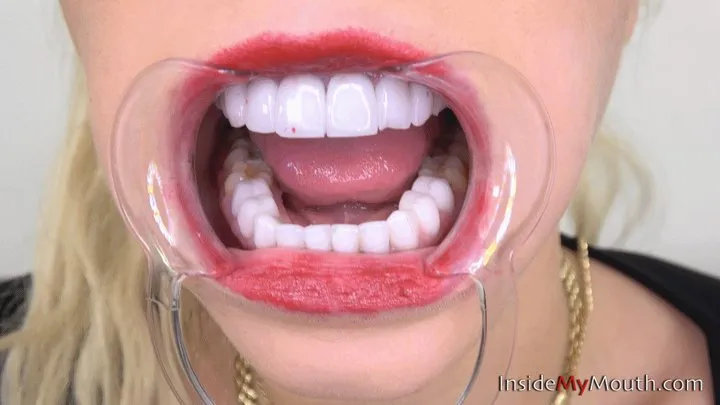 Inside My Mouth - Barbie Sins - Mouth retractor time! ( quality)