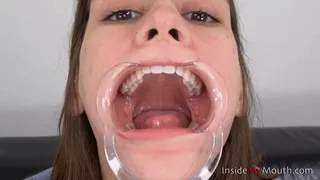 Inside My Mouth - Hellen - Mouth retractor clip!