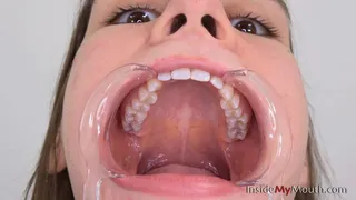 Inside My Mouth - Hellen - Mouth retractor clip!