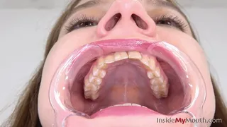 Inside My Mouth - Lola - Mouth retractor clip! ( quality)