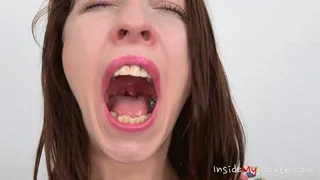 Inside My Mouth - Chanel Kiss - yawning and missing teeth ( )