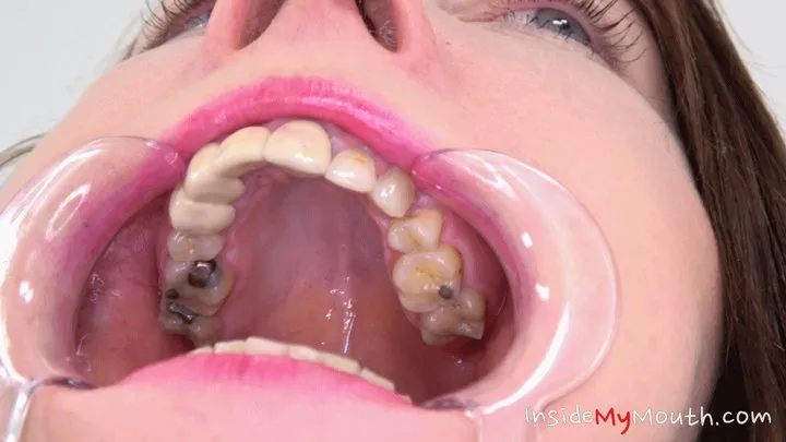 Inside My Mouth - Chanel Kiss - mouth examination and exploration part 2