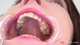Inside My Mouth - Chanel Kiss - mouth examination and exploration part 2