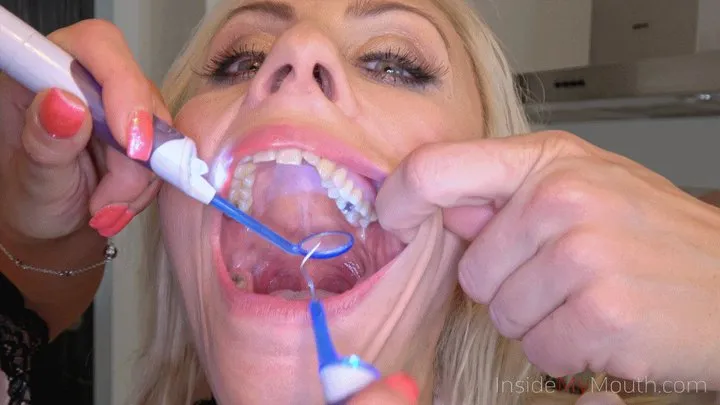 Inside My Mouth - Silvia and Brittany have a dental checkup