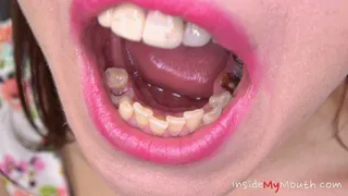 Inside My Mouth - Chanel Kiss - mouth examination and exploration part 1