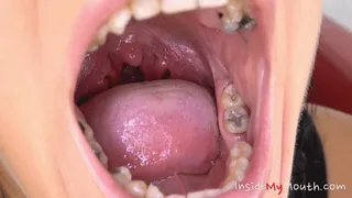 Inside My Mouth - Lexi Dona - mouth examination and exploration