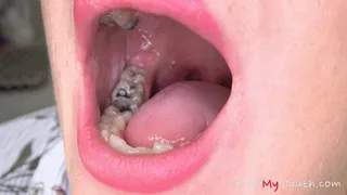 Inside My Mouth - Vanessa's mouth examination and exploration