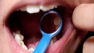 Teeth Exploration