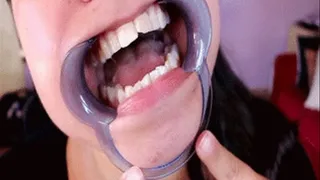 Wide Open Mouth (+ dental cavity!)